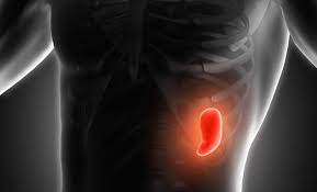 النشاط المفرط للطحال