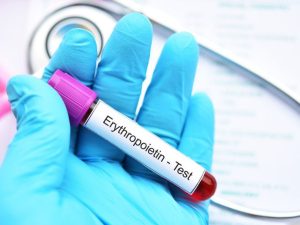 انخفاض مستويات الإريثروبويتين