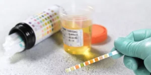 تحليل الألبومين