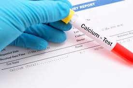 تحليل الكالسيوم