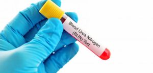 تحليل نيتروجين يوريا الدم