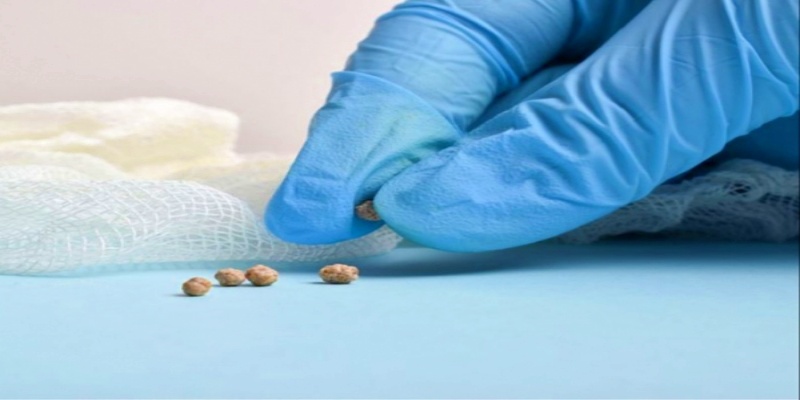 كم من الوقت يحتاج مرضى حصوات الكلى للتخص منها؟