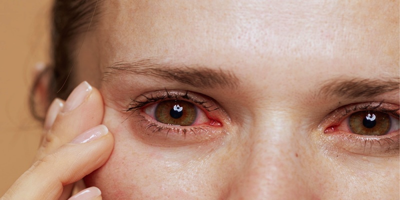 ما هي العلاقة بين متلازمة جفاف العين ونقص أوميغا-3 داخل الجسم؟