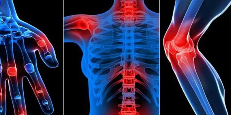 ما هي المضاعفات الصحية الناتجة عن مرض التهاب المفاصل الروماتويدي؟