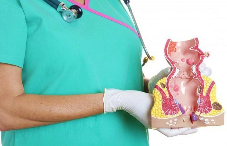 ما هي مضاعفات الإصابة بأزمة البواسير الخارجية؟