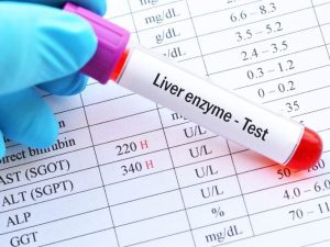 ماالمقصود بإرتفاع إنزيمات الكبد ؟