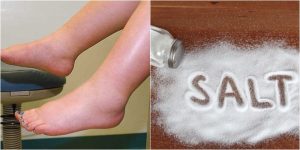 ماذا تعني حساسية الملح ؟