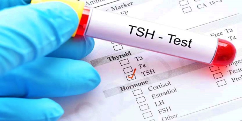 اختبار TSH