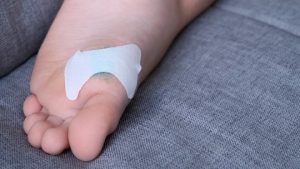 العلاجات المنزلية لعين السمكة