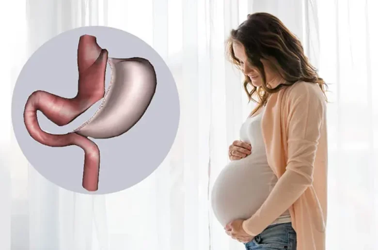 الوقت المثالي للتخطيط للحمل بعد إجراء تكميم للمعدة