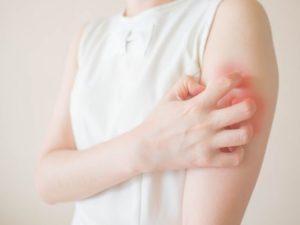 كيف نميز بين أعراض الحساسية وحمو النيل ؟