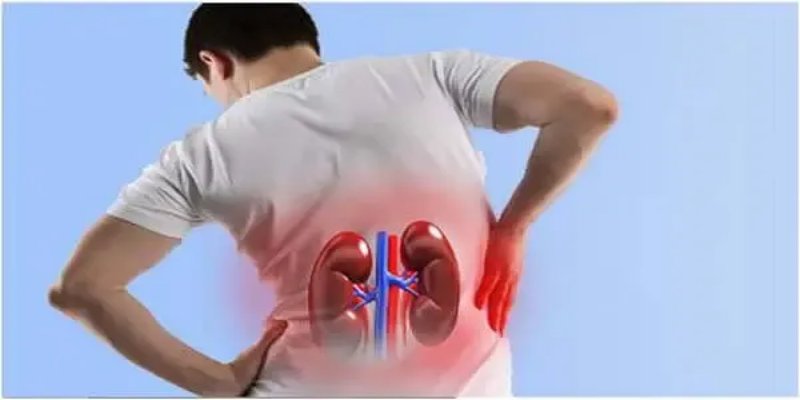 متلازمة حمى الضنك مع الفشل الكلوي (HFRS)