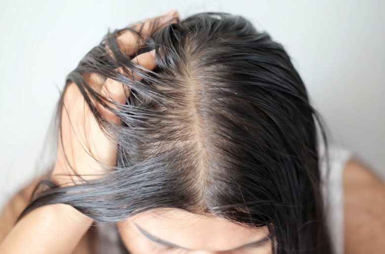 أسباب تؤدي إلى زيادة دهنية الشعر عقب يوم واحد من غسله