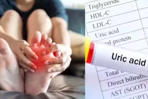 فوائد الفواكه الصفراء لمن يعانون من فرط حمض اليوريك