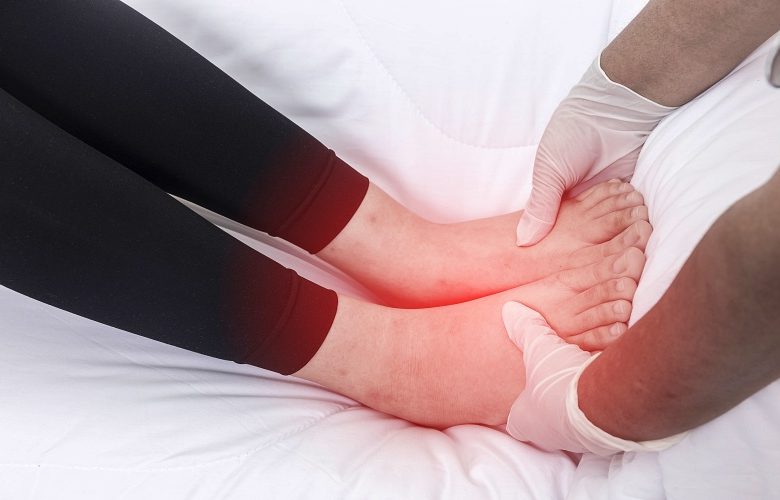 مرحلة ما قبل انقطاع الطمث وزيادة فرص ظهور وذمات الساق