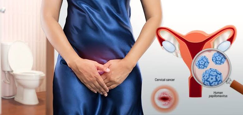 العلاقة بين عدوى السنط وتقنية الليزر
