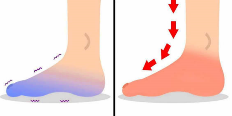 دعم الدورة الدموية في الساقين