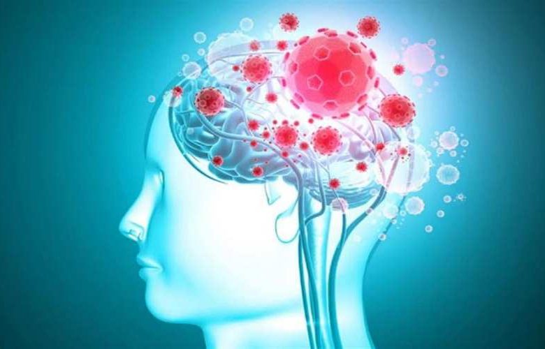 علامات وأعراض خطيرة تدل على الإصابة بالتهاب الدماغ الفيروسي