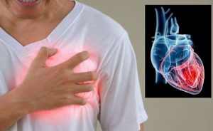 ماذا يحدث عقب التعرض للجلطة للمرة الثانية ؟