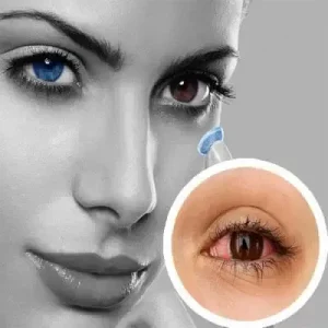 أعراض شائعة تمنع ارتداء العدسات اللاصقة