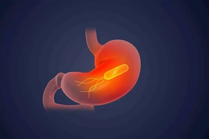 جرثومة المعدة لدى الرضع