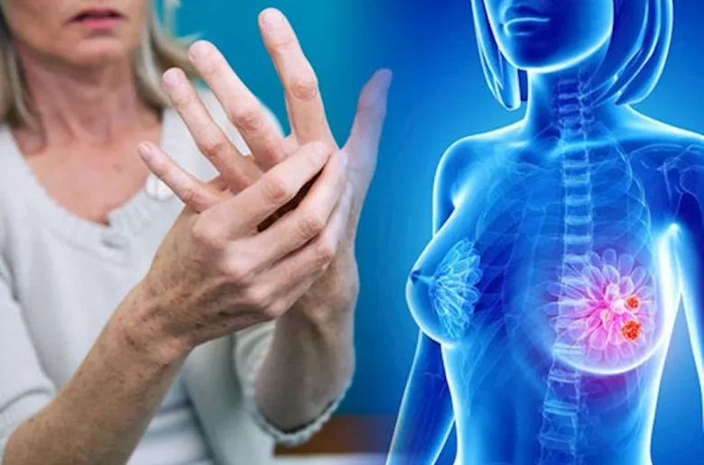 علامات غير متوقعة لسرطان الثدي تظهر على الذراع
