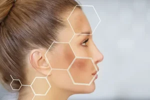 ماهي أوجه المقارنة بين حمض الكوجيك وفيتامين سي ؟