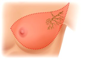 متى يكون الإختلاف في نسب إدرار الحليب علامة مرضية ؟