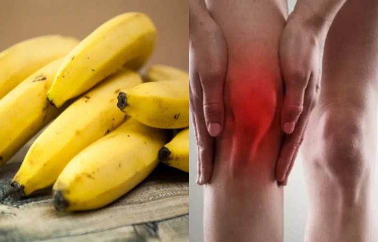 مرضى النقرس وتناول فاكهة الموز