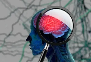 نقص الفيتامينات المؤدي للإصابة بالخرف