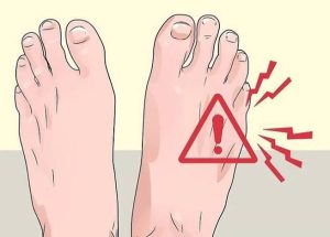 هل يعد نزيف الساقين من أعراض مرضى السكري ؟