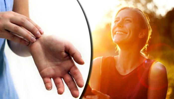 أهمية التعرض لأشعة الشمس في علاج الإكزيما