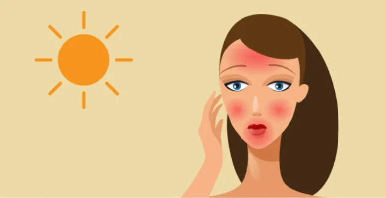 تهيج البشرة عقب استعمال منتجات واقي الشمس