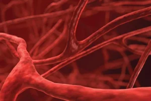 اضطرابات الأوعية الدموية