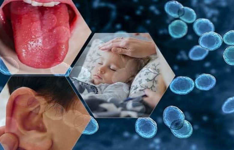 الأمراض التي تسببها عدوى المكورات العقدية من المجموعة أ