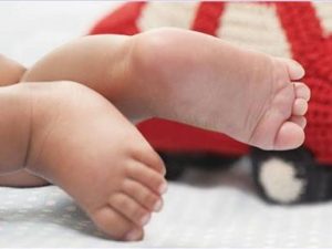 تعرق القدمين لدى حديثي الولادة