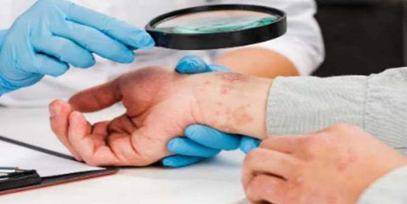 طلب الفحص والعلاج المبكر عند ظهور أعراض مرضية